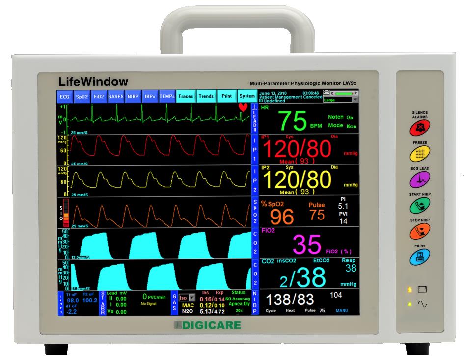 LifeWindow 9x MRI Monitoring Products MRI Safe